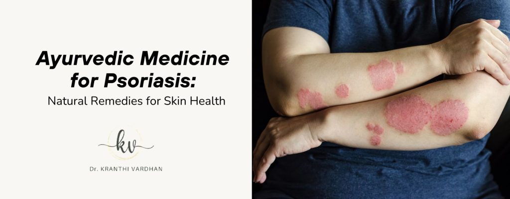 Ayurvedic Medicine for Psoriasis: Natural Remedies for Skin Health 25 Natural Remedies for Skin Health