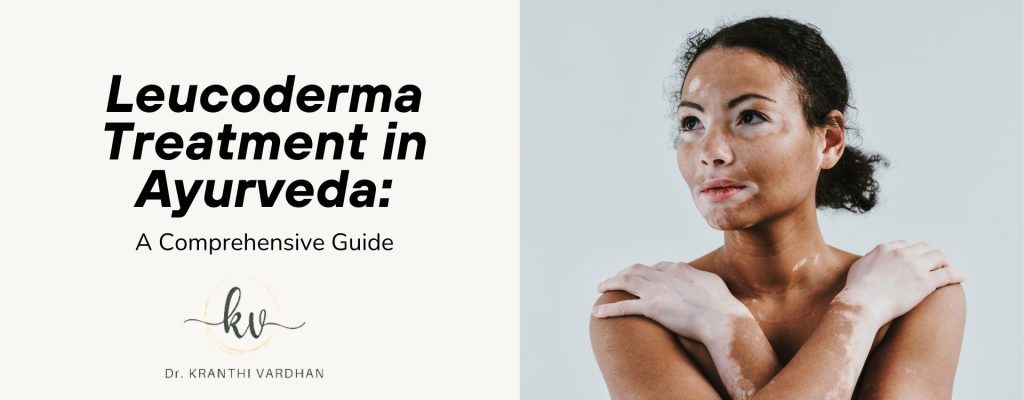 Leucoderma Treatment in Ayurveda: A Comprehensive Guide 13 Leucoderma Treatment in Ayurveda1