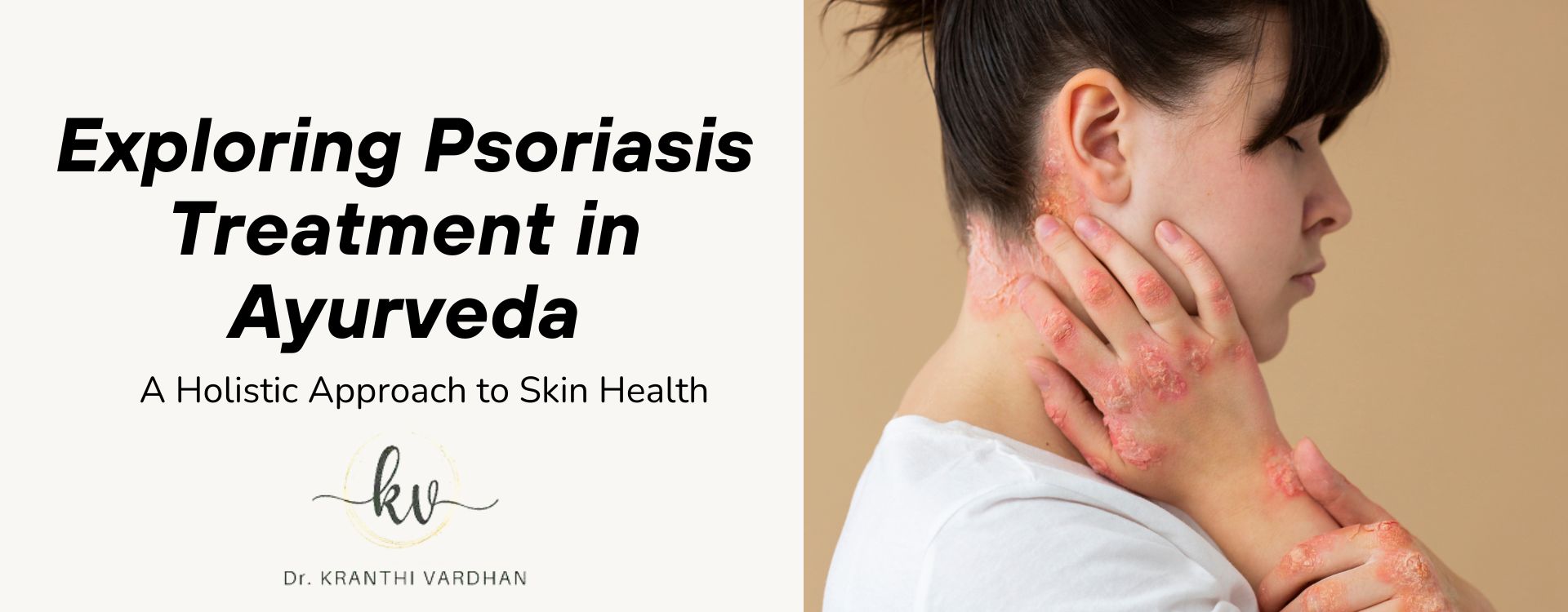 Exploring Psoriasis Treatment in Ayurveda: A Holistic Approach to Skin Health