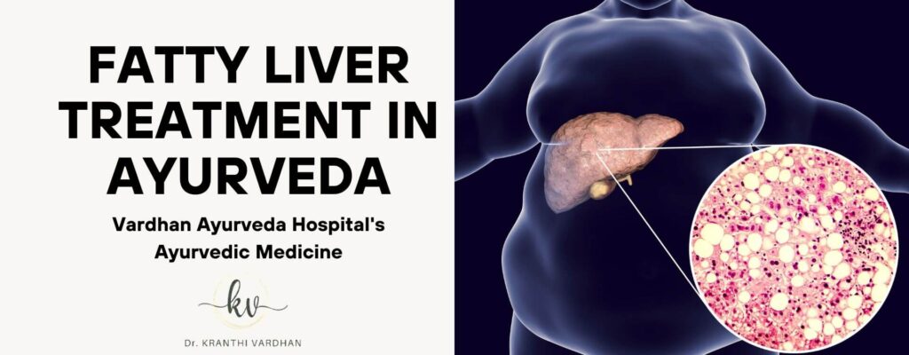 Fatty Liver Treatment in Ayurveda: Vardhan Ayurveda Hospital's Ayurvedic Medicine 6 Fatty Liver Treatment in Ayurveda