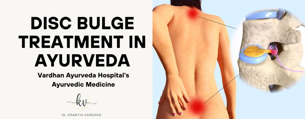 Disc Bulge Treatment in Ayurveda: Vardhan Ayurveda Hospital's Ayurvedic Medicine 6 Disc Bulge Treatment in Ayurveda