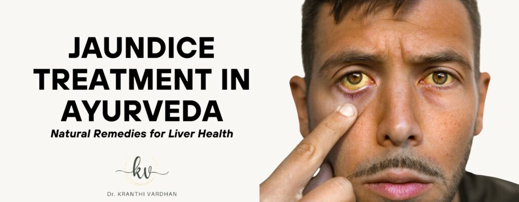 Jaundice Treatment in Ayurveda: Natural Remedies for Liver Health 1 Jaundice Treatment